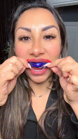 FreshMint Daily Smile Whitening Strips