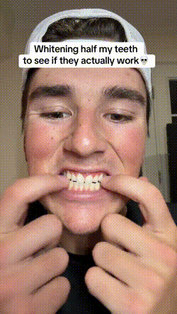 FreshMint Daily Smile Whitening Strips